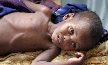 Nações Unidas/ Quase dois milhões de crianças menores de cinco anos de Somália correm o risco de sofrer desnutrição aguda