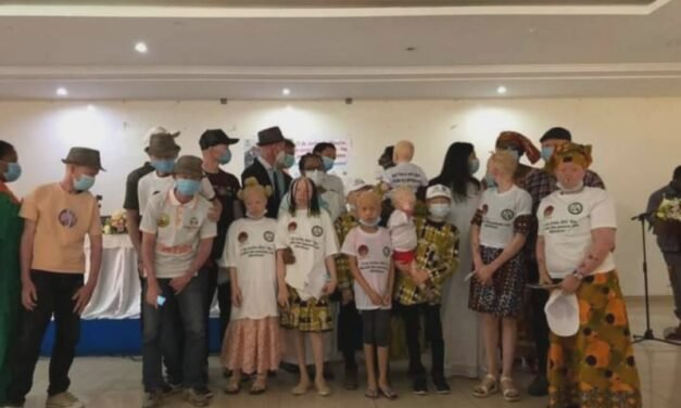 Associação Juvenil apela ao reforço da proteção e inclusão das pessoas com albinismo na Guiné-Bissau